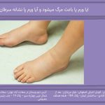 ایا ورم پا باعث مرگ میشود