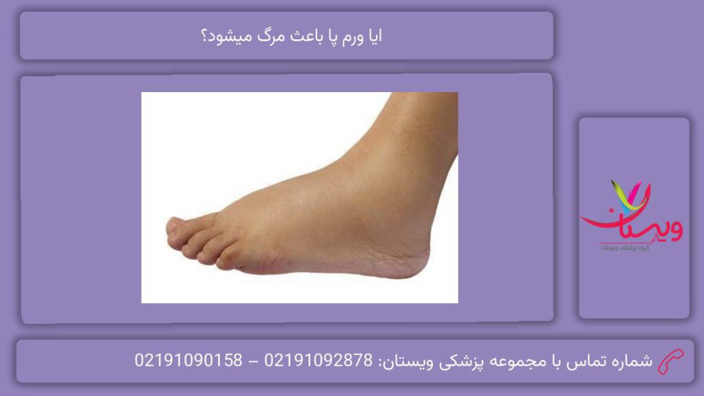 ایا ورم پا باعث مرگ میشود؟