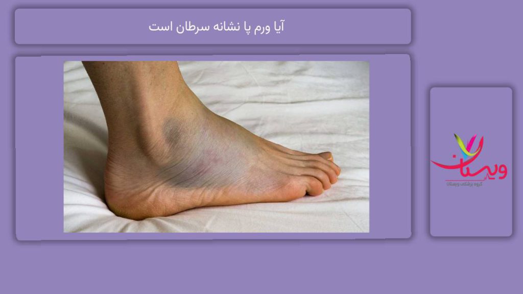 آیا ورم پا نشانه سرطان است
