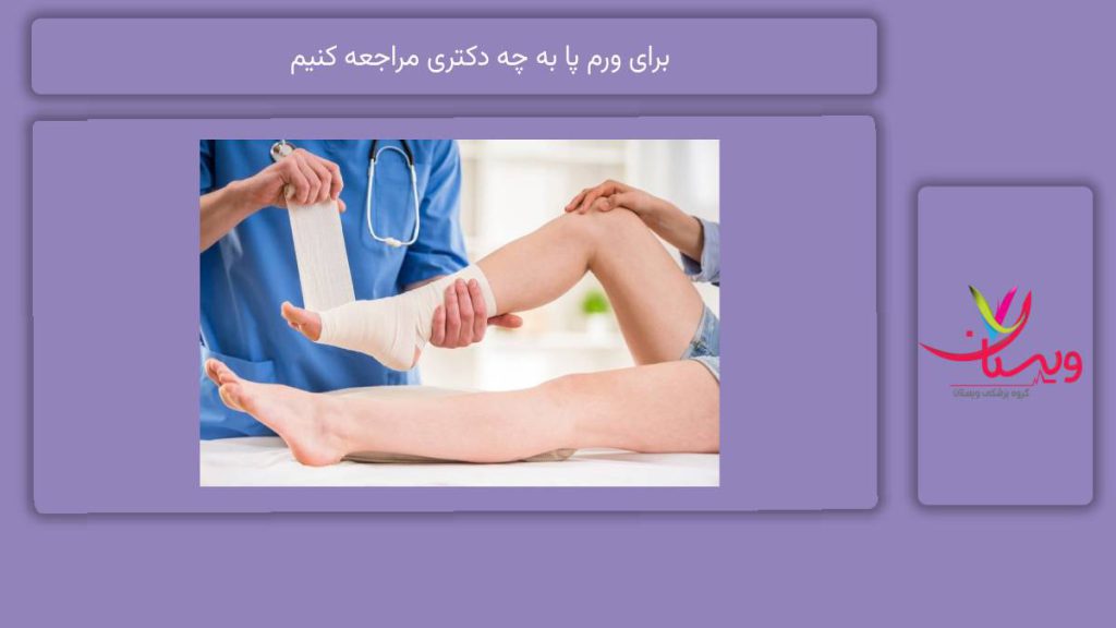 دکترهای مناسب ورم پا برای ورم پا به چه دکتری مراجعه کنیم