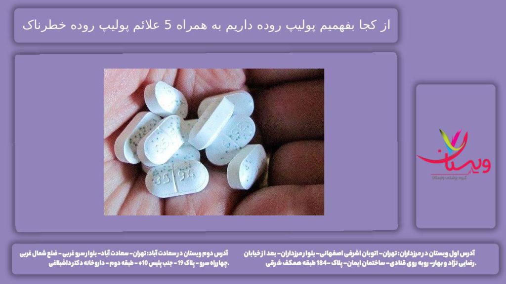 از کجا بفهمیم پولیپ روده داریم