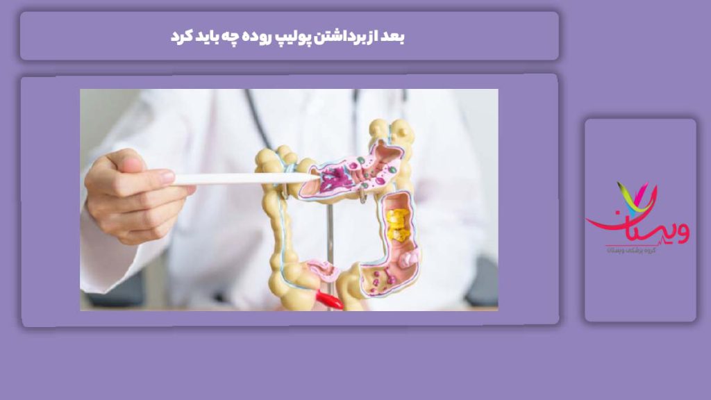 کارهایی که بعد از برداشتن پولیپ باید انجام داد. بعد از برداشتن پولیپ روده چه باید کرد