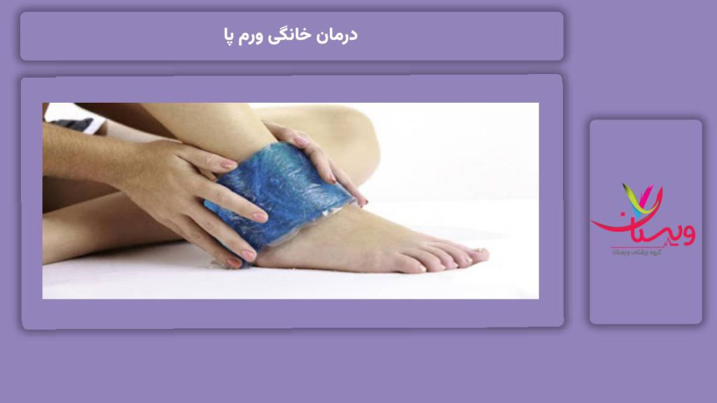 درمان خانگی ورم پا