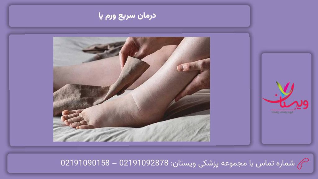 درمان سریع ورم پا