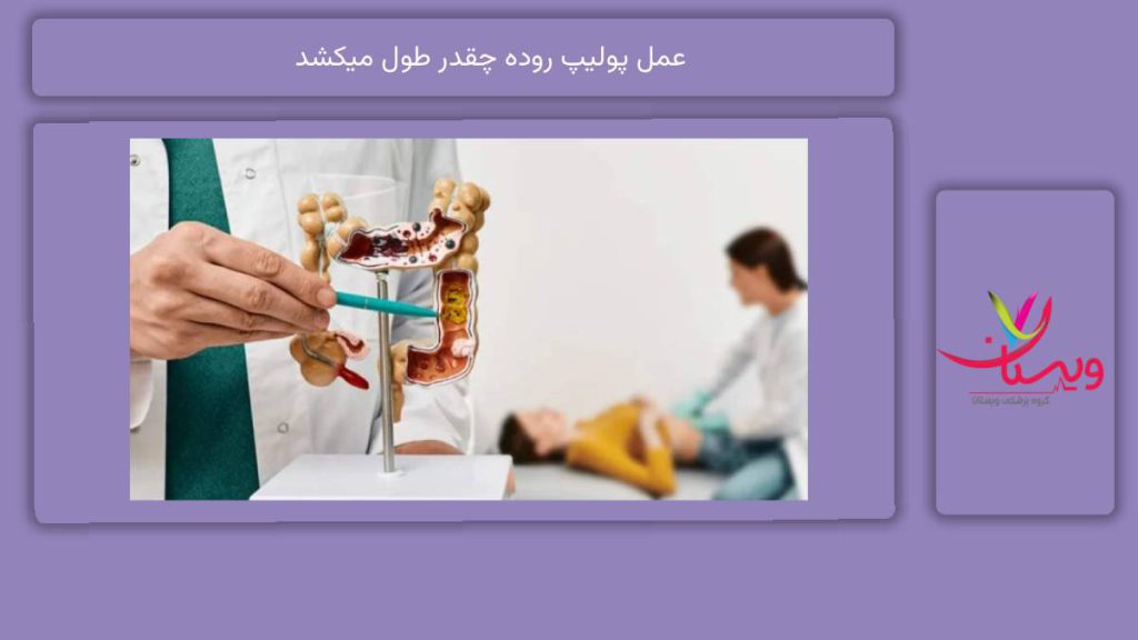 زمان انجام دادن پولیپ روده عمل پولیپ روده چقدر طول میکشد